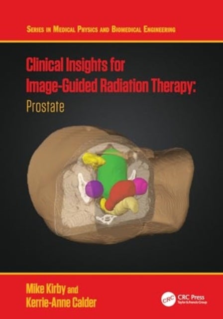 Clinical Insights for Image-Guided Radiotherapy - Prostate