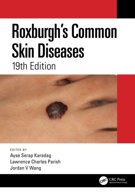 Roxburgh''s Common Skin Diseases