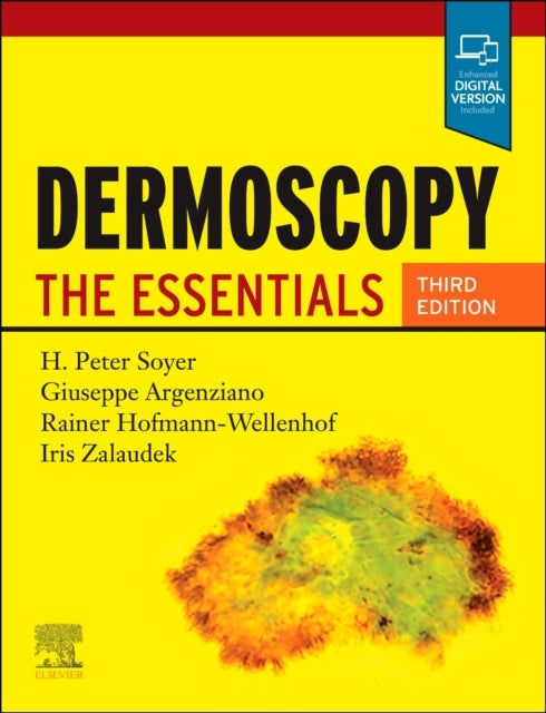 Dermoscopy - The Essentials