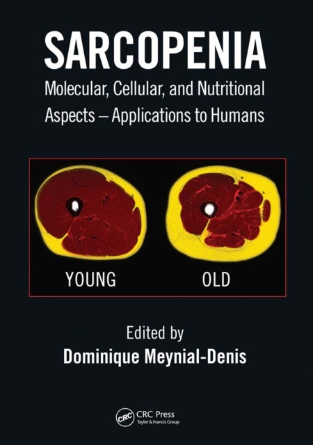 Sarcopenia - Molecular, Cellular, and Nutritional Aspects – Applications to Humans
