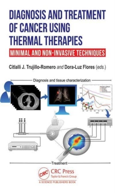 Diagnosis and Treatment of Cancer Using Thermal Therapies - Minimal and Non-invasive Techniques
