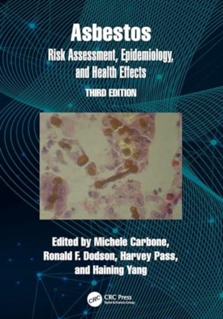 Asbestos - Risk Assessment, Epidemiology, and Health Effects