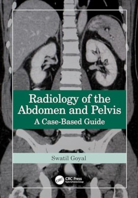 Radiology of the Abdomen and Pelvis - A Case-Based Guide
