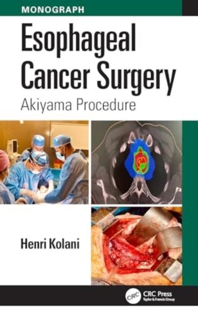 Esophageal Cancer Surgery - Akiyama Procedure