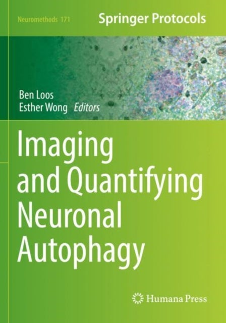 Imaging and Quantifying Neuronal Autophagy