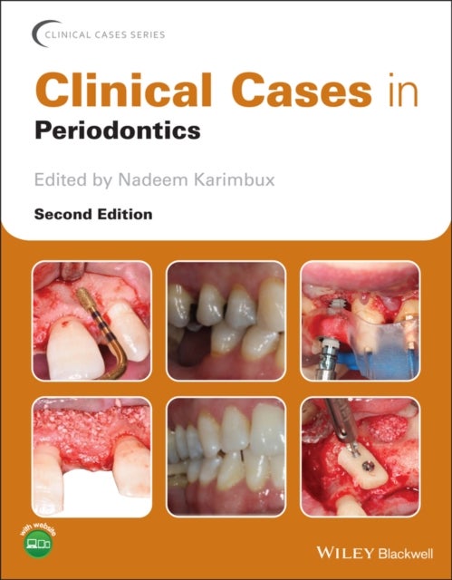 Clinical Cases in Periodontics 2e