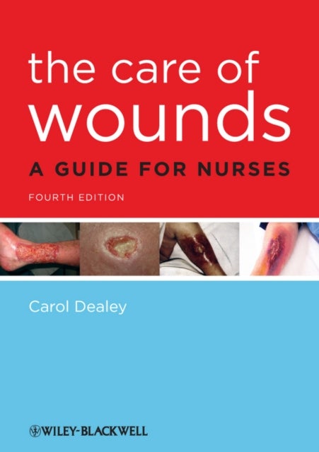 The Care of Wounds – A Guide for Nurses 4e - A Guide for Nurses