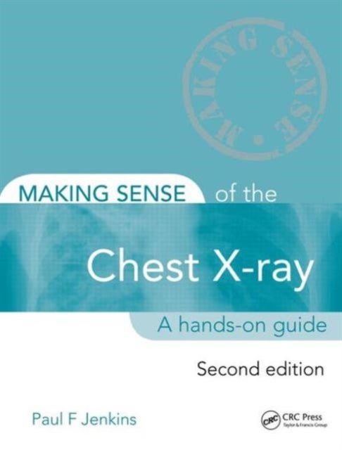 Making Sense of the Chest X-ray - A hands-on guide