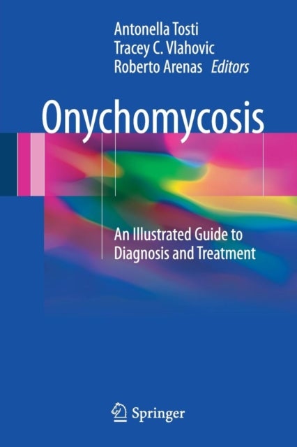 Onychomycosis - An Illustrated Guide to Diagnosis and Treatment