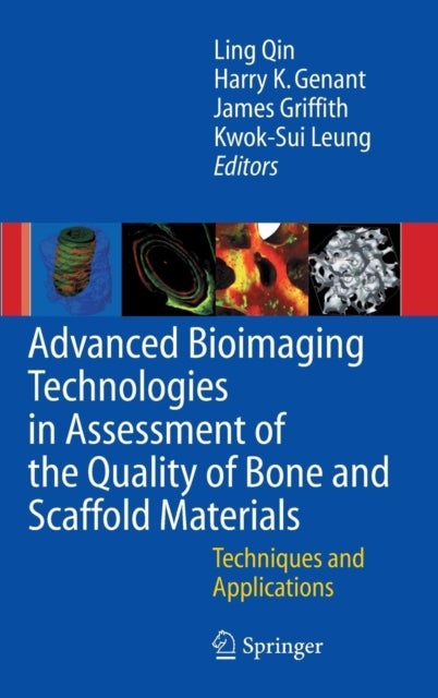 Advanced Bioimaging Technologies in Assessment of the Quality of Bone and Scaffold Materials - Techniques and Applications