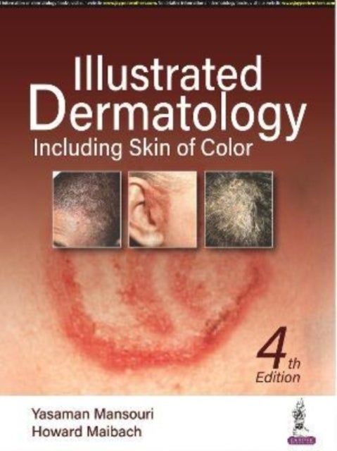 Illustrated Dermatology - Including Skin of Colour