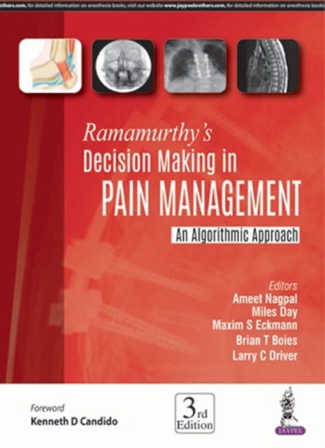 Ramamurthy''s Decision Making in Pain Management - An Algorithmic Approach