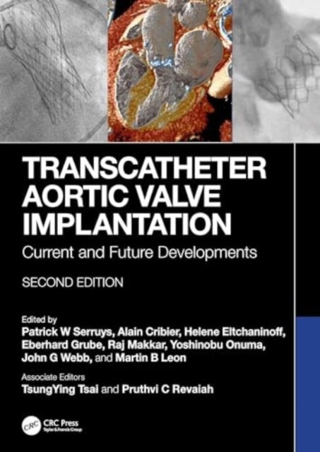 Transcatheter Aortic Valve Implantation - Current and Future Developments
