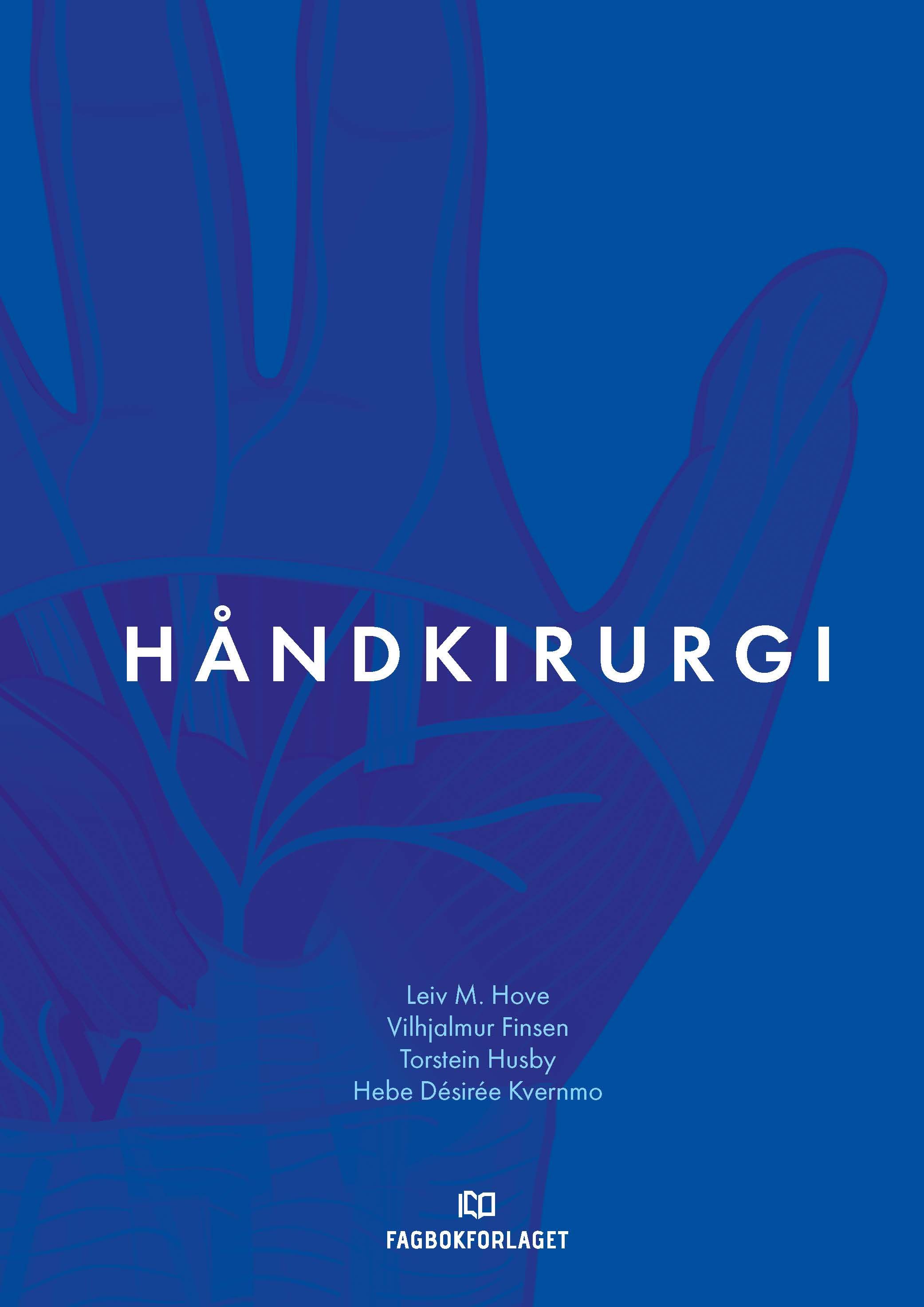 Håndkirurgi