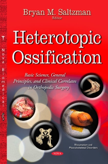 Heterotopic Ossification - Basic Science, General Principles & Clinical Correlates in Orthopedic Surgery