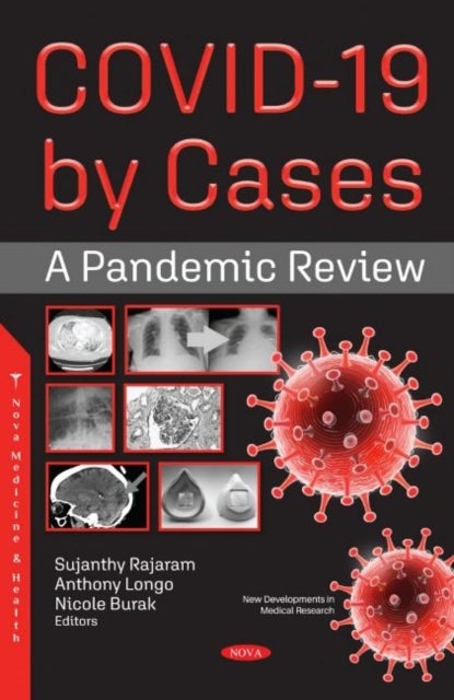 COVID-19 by Cases - A Pandemic Review