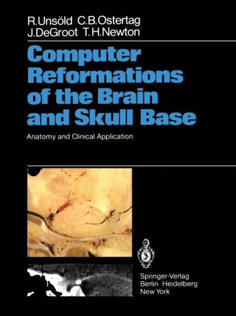 Computer Reformations of the Brain and Skull Base - Anatomy and Clinical Application