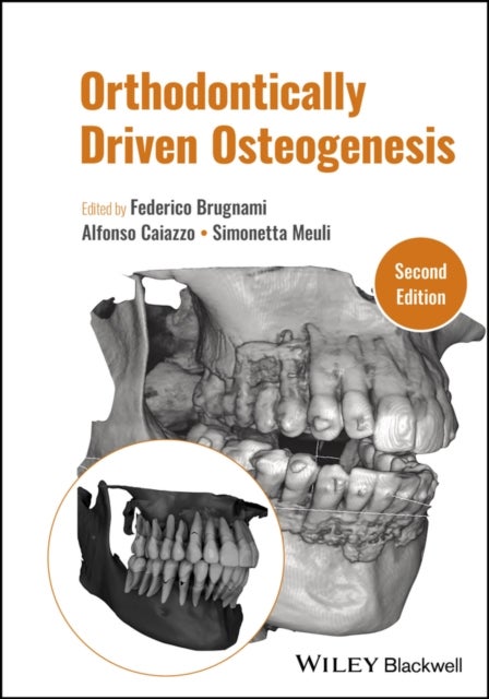Orthodontically Driven Osteogenesis, Second Edition