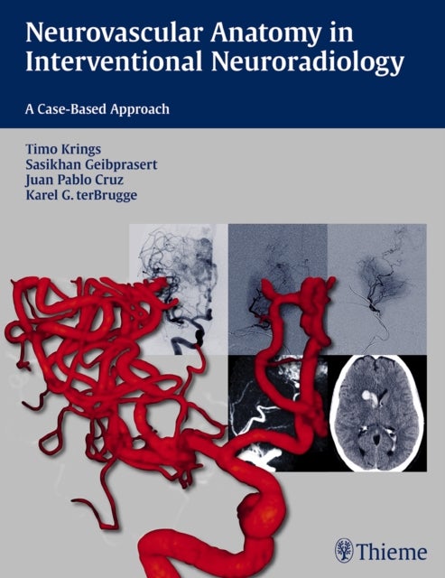 Neurovascular Anatomy in Interventional Neurorad – A Case–Based Approach - A Case-Based Approach