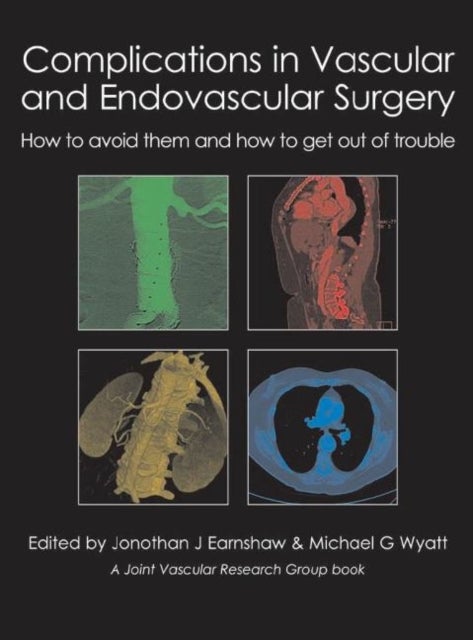 Complications in Vascular & Endovascular Surgery - How to avoid them and how to get out of trouble
