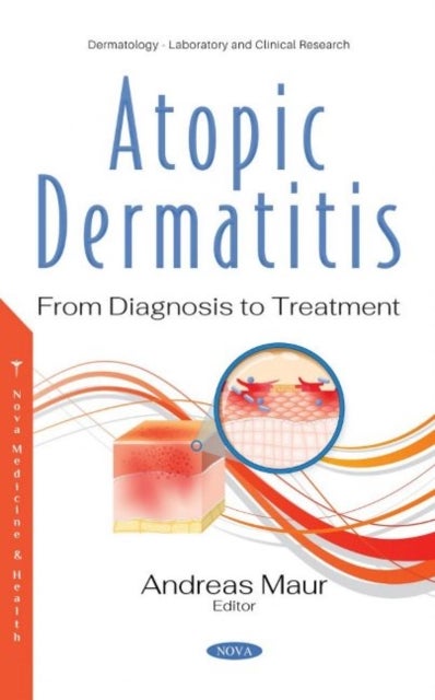 Atopic Dermatitis - From Diagnosis to Treatment
