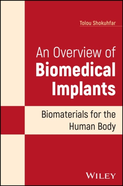 An Overview of Biomedical Implants – Biomaterials  for the Human Body - Biomaterials for the Human Body