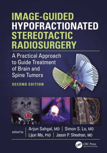 Image-guided Hypofractionated Stereotactic Radiosurgery - A Practical Approach to Guide Treatment of Brain and Spine Tumors