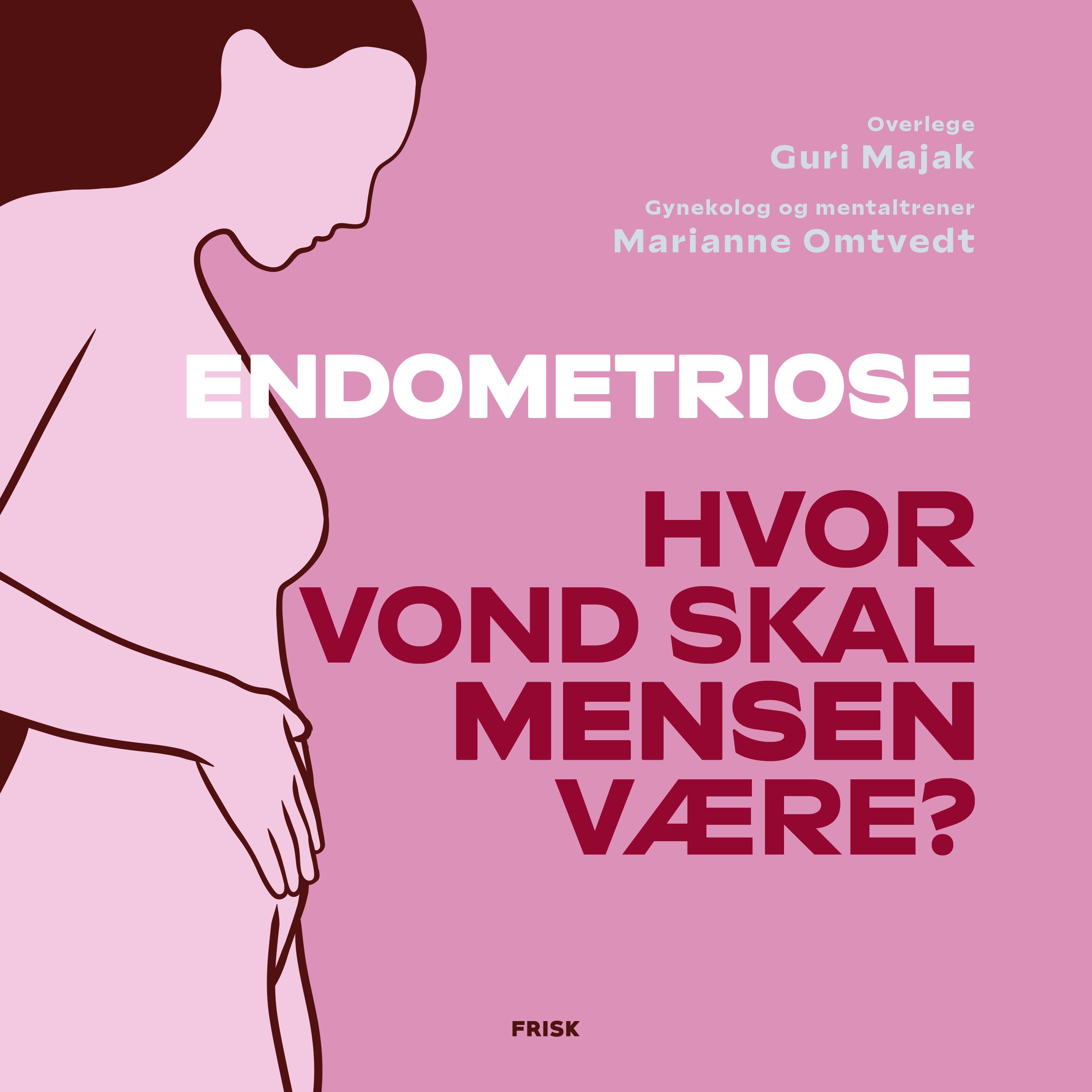 Endometriose - hvor vond skal mensen være?