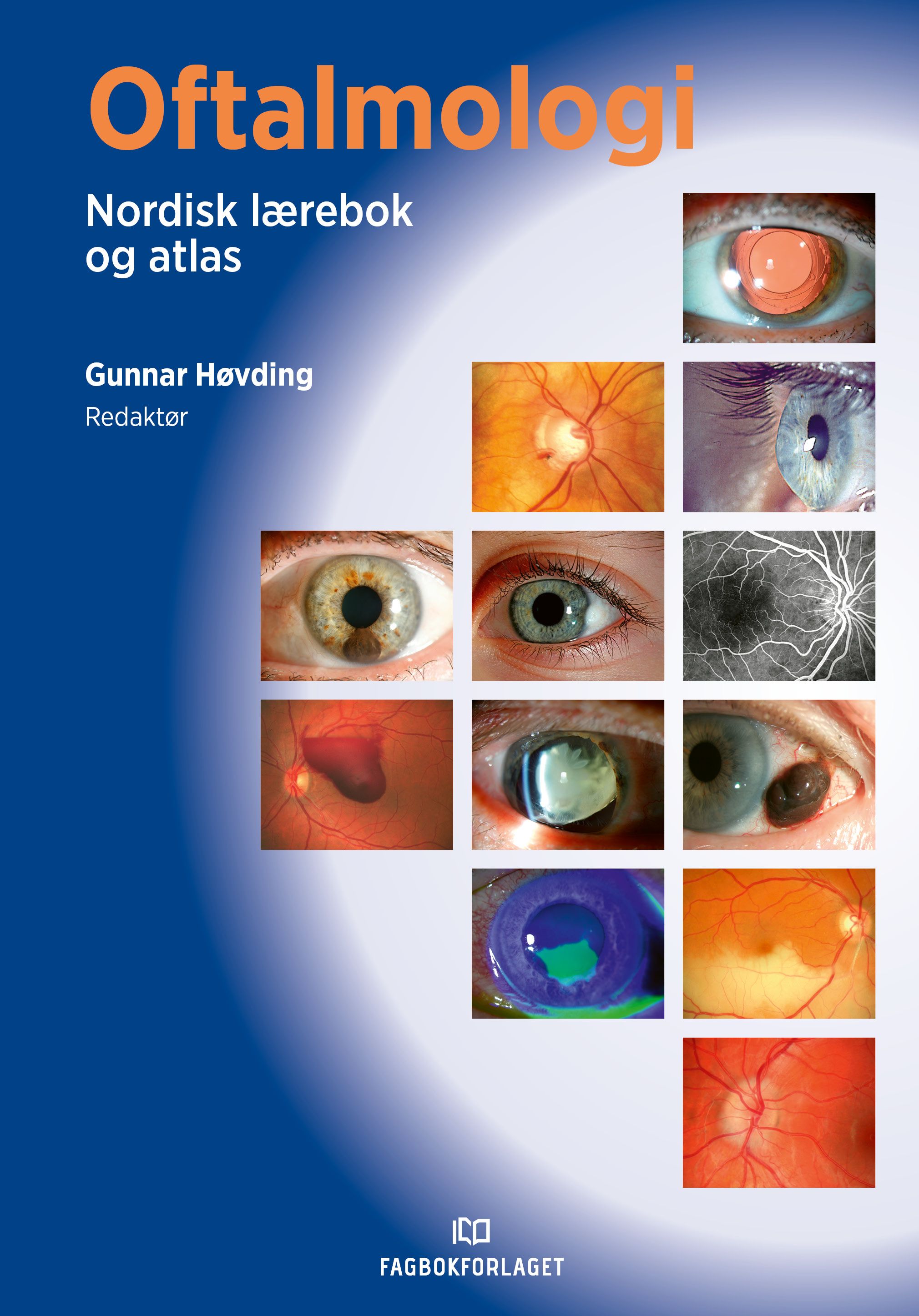 Oftalmologi - nordisk lærebok og atlas