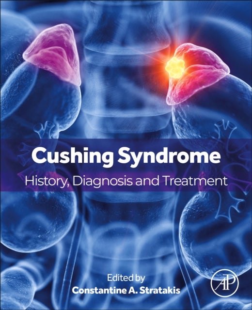 Cushing Syndrome - History, Diagnosis and Treatment