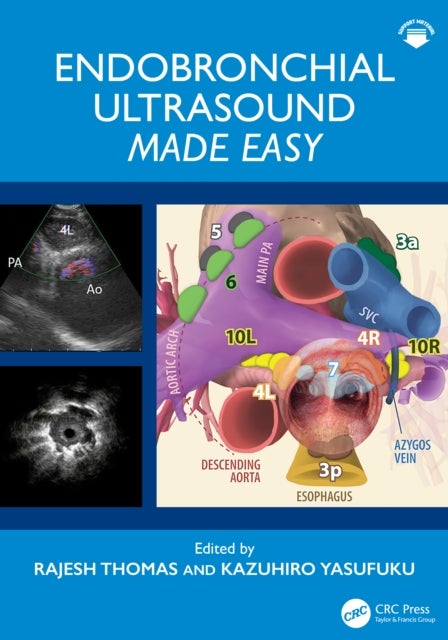 Endobronchial Ultrasound