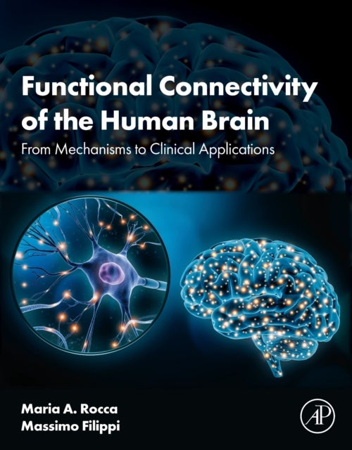 Functional Connectivity of the Human Brain - From Mechanisms to Clinical Applications