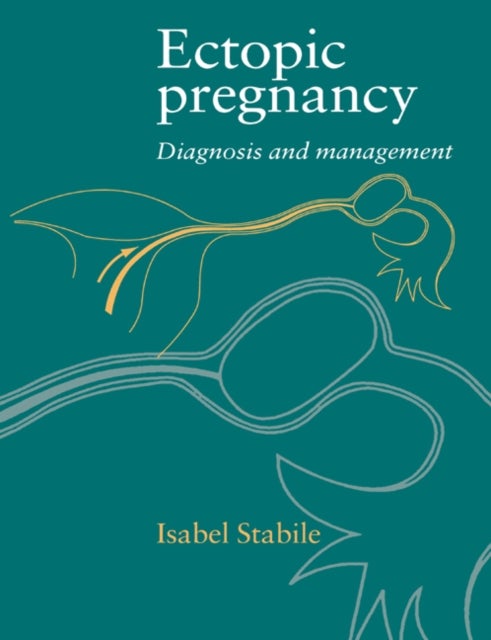 Ectopic Pregnancy - Diagnosis and Management