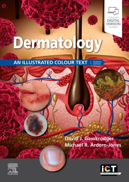 Dermatology: An Illustrated Colour Text 7ed
