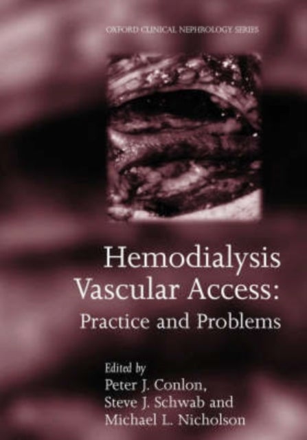 Hemodialysis Vascular Access - Practice and problems