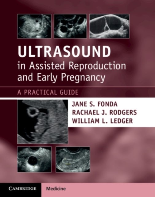 Ultrasound in Assisted Reproduction and Early Pregnancy - A Practical Guide