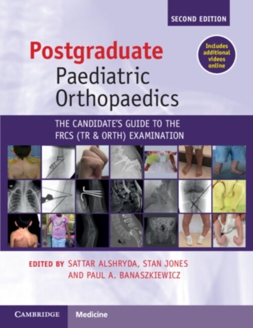 Postgraduate Paediatric Orthopaedics - The Candidate's Guide to the FRCS(Tr&Orth) Examination