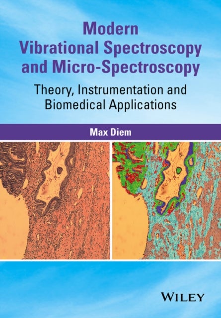 Modern Vibrational Spectroscopy & Micro–Spectroscopy – Theory, Instrumentation & Biomedical Applications - Theory, Instrumentation and Biomedical Applications