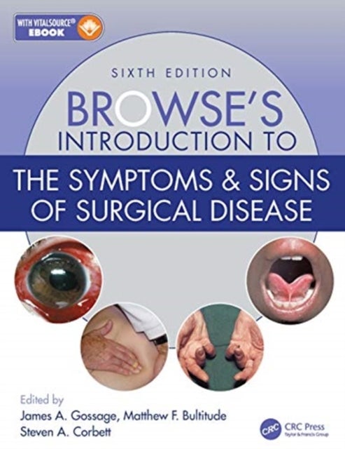 Browse''s Introduction to the Symptoms & Signs of Surgical Disease