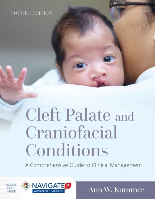 Cleft Palate and Craniofacial Conditions: a Comprehensive Guide to Clinical Management - A Comprehensive Guide to Clinical Management