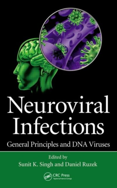 Neuroviral Infections - General Principles and DNA Viruses