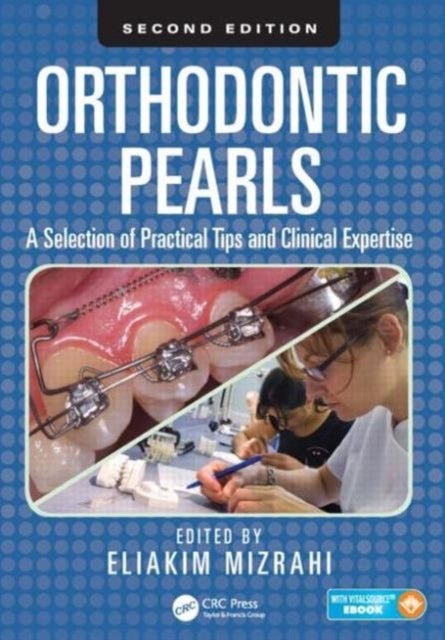 Orthodontic Pearls - A Selection of Practical Tips and Clinical Expertise, Second Edition