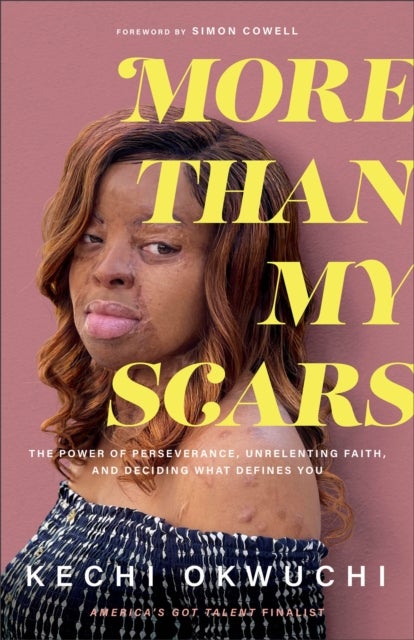 More Than My Scars ¿ The Power of Perseverance, Unrelenting Faith, and Deciding What Defines You