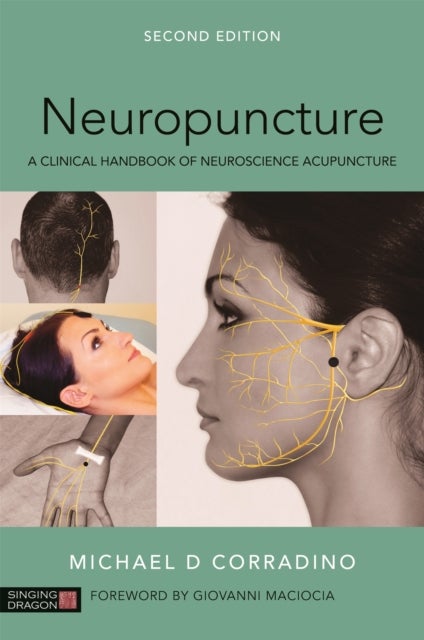 Neuropuncture - A Clinical Handbook of Neuroscience Acupuncture