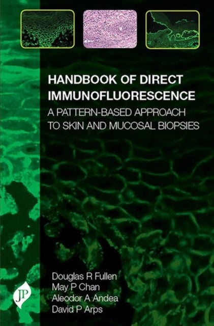 Handbook of Direct Immunofluorescence - A Pattern-Based Approach to Skin and Mucosal Biopsies