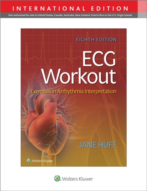 ECG Workout - Exercises in Arrythmia Interpretation