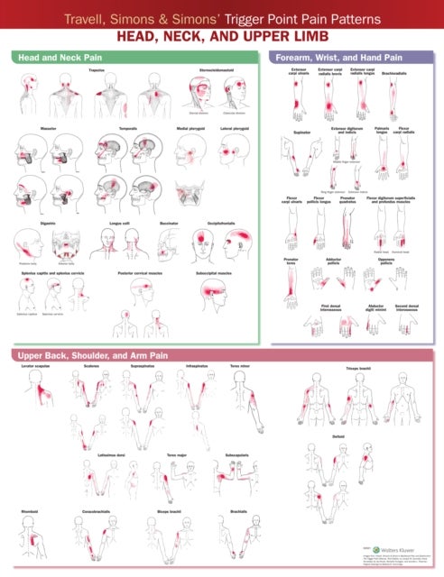 Travell, Simons & Simons’ Trigger Point Pain Patterns Wall Chart - Head, Neck, and Upper Limb