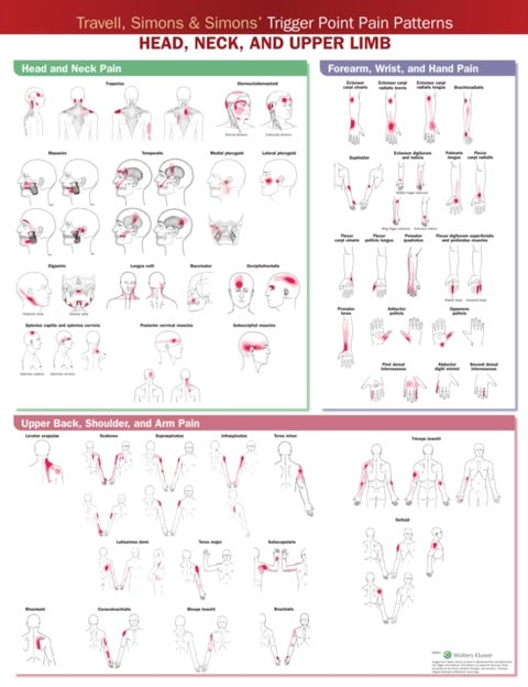 Travell, Simons & Simons’ Trigger Point Pain Patterns Wall Chart - Head, Neck, and Upper Limb