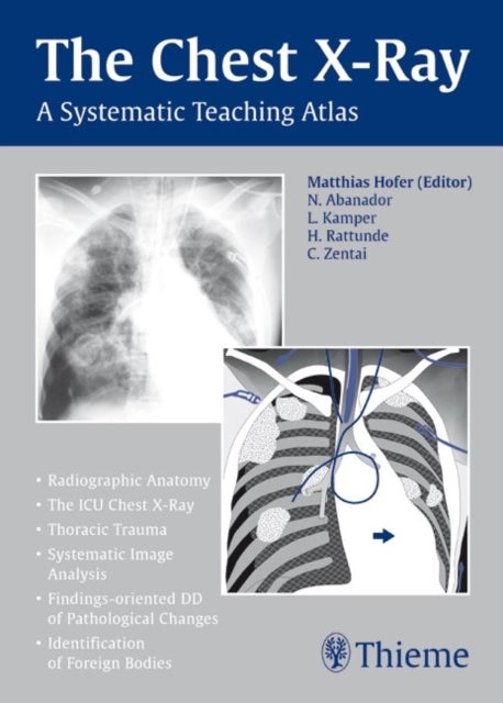 The Chest X-Ray - A Systematic Teaching Atlas