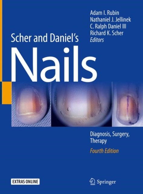Scher and Daniel''s Nails - Diagnosis, Surgery, Therapy